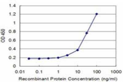 ELISA: Laforin/EPM2A Antibody (4A12) [H00007957-M01]