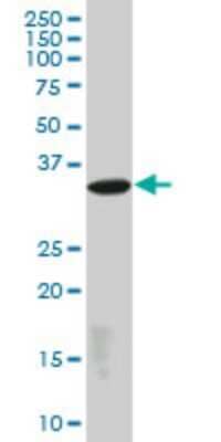 Western Blot: Laforin/EPM2A Antibody (4A12) [H00007957-M01]