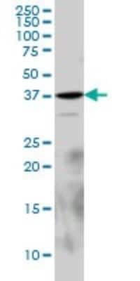 Western Blot: Laforin/EPM2A Antibody (6C6) [H00007957-M02]