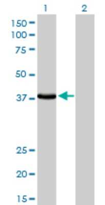 Western Blot: Laforin/EPM2A Antibody (6C6) [H00007957-M02]