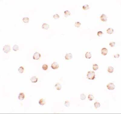 Immunocytochemistry/ Immunofluorescence: Laforin/EPM2A Antibody - BSA Free [NBP2-81945]