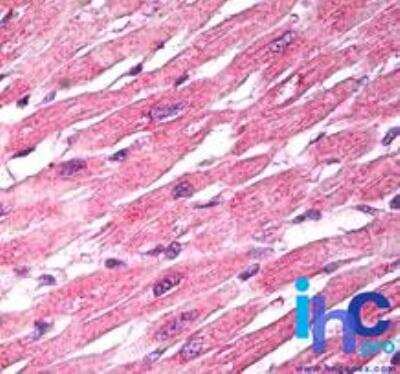Immunohistochemistry-Paraffin: Laforin/EPM2A Antibody [NBP2-24474]