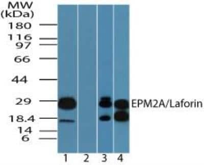 Western Blot: Laforin/EPM2A Antibody [NBP2-24474]