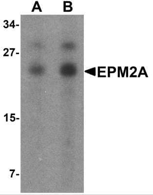 Western Blot: Laforin/EPM2A AntibodyBSA Free [NBP2-81945]