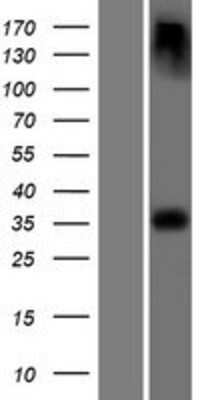 Western Blot: Laforin/EPM2A Overexpression Lysate [NBP2-10449]