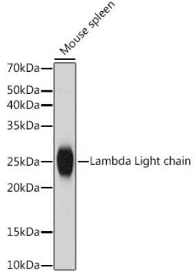 Western Blot: Lambda Light Chain Antibody (1R9H8) [NBP3-15947]