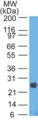 Western Blot: Lambda Light Chain Antibody (HP6054)Azide and BSA Free [NBP2-33309]