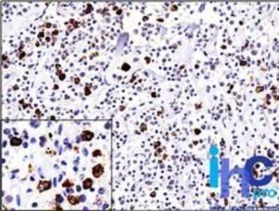 Immunohistochemistry-Paraffin: Lambda Light Chain Antibody (ICO-106) [NBP2-29462]