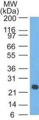 Western Blot: Lambda Light Chain Antibody (LcN-2 + ICO-106)Azide and BSA Free [NBP2-34665]