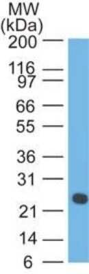 Western Blot: Lambda Light Chain Antibody (LcN-2 + ICO-106) [NBP2-34236]