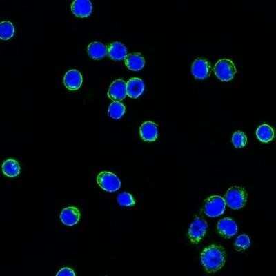 Immunocytochemistry/ Immunofluorescence: Lambda Light Chain Antibody (LcN-2) [NBP2-62751]