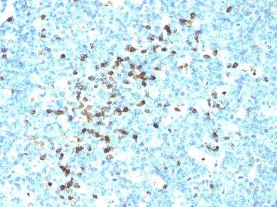 Immunohistochemistry-Paraffin: Lambda Light Chain Antibody (LcN-2) [NBP2-62751]