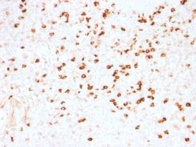 Immunohistochemistry-Paraffin: Lambda Light Chain Antibody (N10/2) [NBP2-53249]