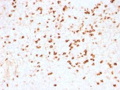 Immunohistochemistry-Paraffin: Lambda Light Chain Antibody (N10/2) - Azide and BSA Free [NBP2-54421]