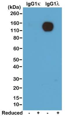 Western Blot: Lambda Light Chain Antibody (RM110) [NBP2-61910]