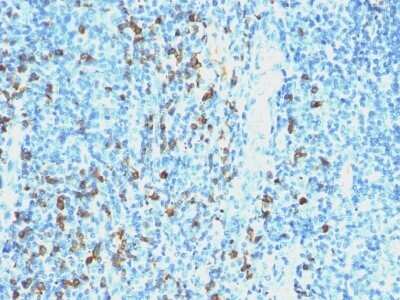 Immunohistochemistry-Paraffin: Lambda Light Chain Antibody (SPM559) - IHC-Prediluted [NBP2-45076]