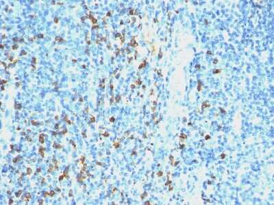 Immunohistochemistry-Paraffin: Lambda Light Chain Antibody (SPM559) [NBP2-34377]