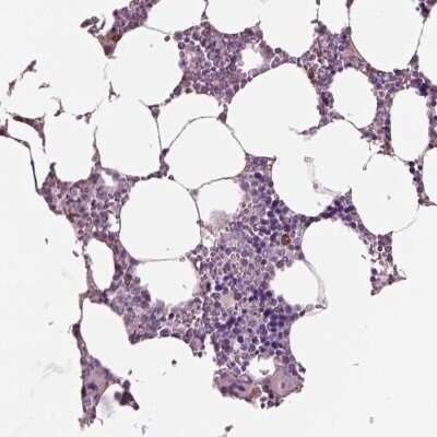 Immunohistochemistry-Paraffin: Lambda5/IGLL1 Antibody [NBP2-56431]