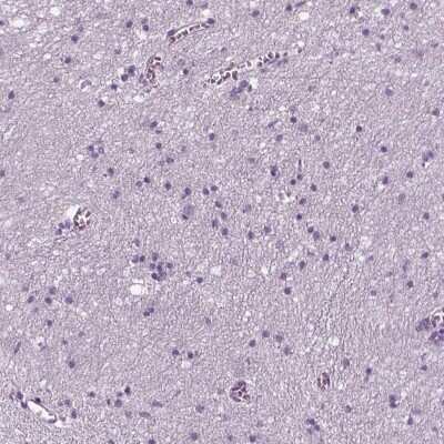 Immunohistochemistry-Paraffin: Lambda5/IGLL1 Antibody [NBP2-56431]