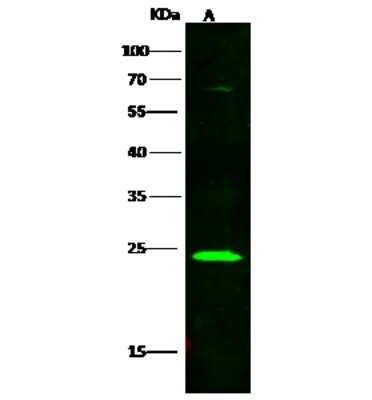 Western Blot: Lambda5/IGLL1 Antibody [NBP2-98929]