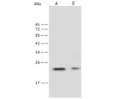 Western Blot: Lambda5/IGLL1 Antibody [NBP2-99452]