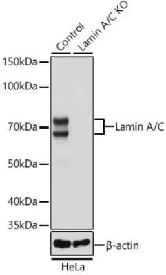 Knockout Validated: Lamin A + C Antibody (4L8Q0) [NBP3-15754]