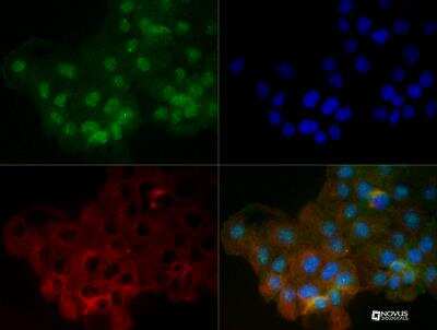 Immunocytochemistry/ Immunofluorescence: Lamin A + C Antibody [NB100-56649]