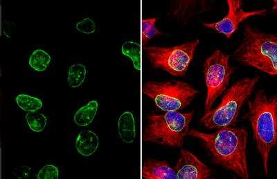 Immunocytochemistry/ Immunofluorescence: Lamin A + C Antibody [NBP2-19324]