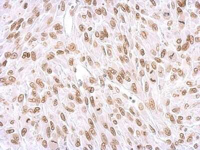 Immunohistochemistry-Paraffin: Lamin A + C Antibody [NBP2-19323]