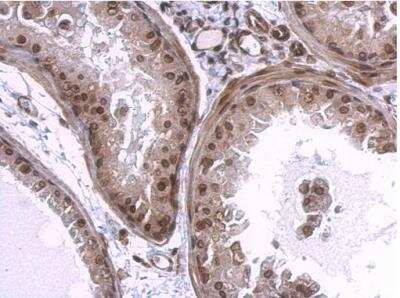 Immunohistochemistry-Paraffin: Lamin A + C Antibody [NBP2-19323]