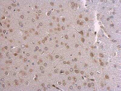 Immunohistochemistry-Paraffin: Lamin A + C Antibody [NBP2-19323]