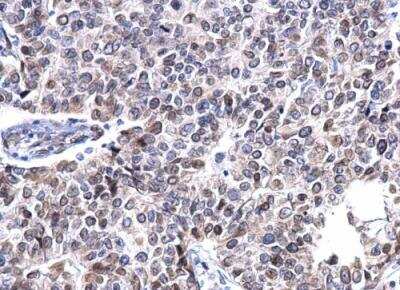 Immunohistochemistry-Paraffin: Lamin A + C Antibody [NBP2-19323]