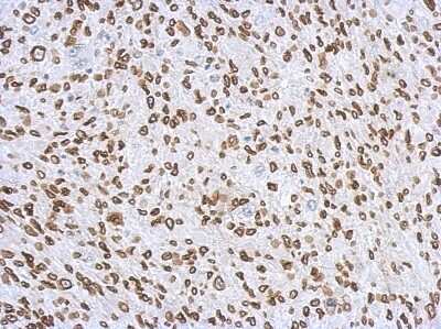 Immunohistochemistry-Paraffin: Lamin A + C Antibody [NBP2-19324]