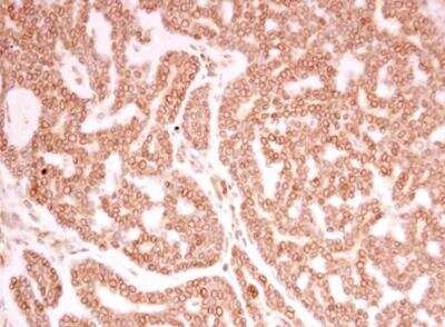 Immunohistochemistry-Paraffin: Lamin A + C Antibody [NBP2-19324]