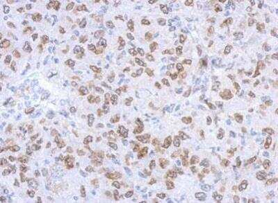 Immunohistochemistry-Paraffin: Lamin A + C Antibody [NBP2-19324]
