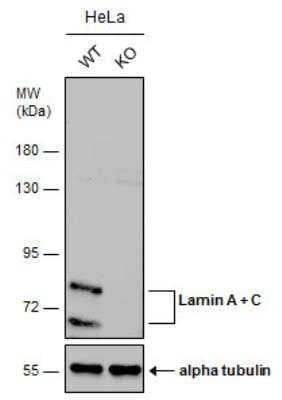 Knockout Validated: Lamin A + C Antibody [NBP2-19323]