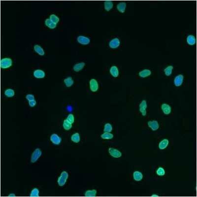 Immunocytochemistry/ Immunofluorescence: Lamin A + C Antibody (mab636) [NB100-74451]