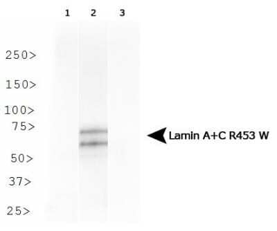 Western Blot: Lamin A + C R453W Antibody (12A-2F5)Azide and BSA Free [NBP2-80823]