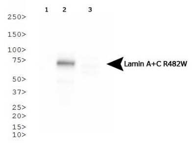 Western Blot: Lamin A + C R482W Antibody (5H8-B4) [NBP1-77402]