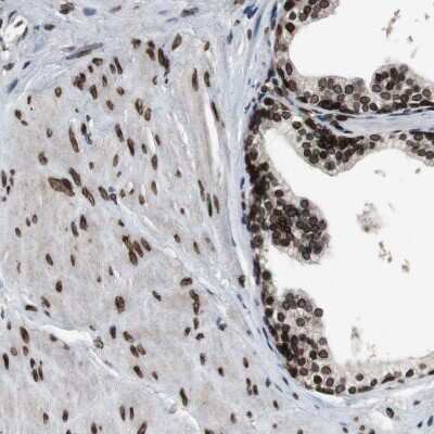 Immunohistochemistry-Paraffin: Lamin A + C Antibody [NBP1-85550]