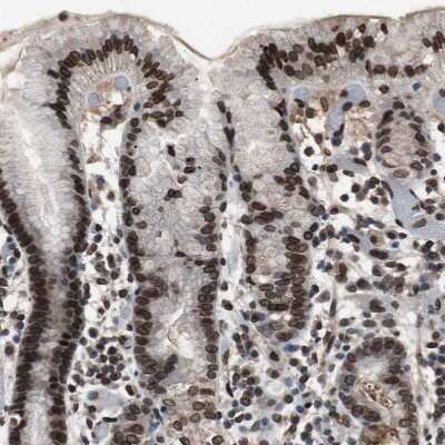 Immunohistochemistry-Paraffin: Lamin A + C Antibody [NBP1-85550]