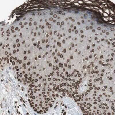 Immunohistochemistry-Paraffin: Lamin A + C Antibody [NBP1-85550]