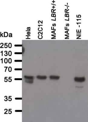 Western Blot: Lamin B Receptor Antibody (BB2SS3F3) [NBP2-59947]