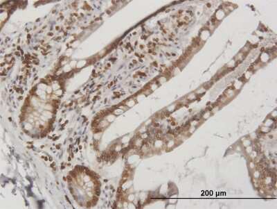 Immunohistochemistry-Paraffin: Lamin B Receptor Antibody [H00003930-B01P]
