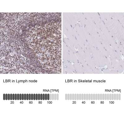 Immunohistochemistry-Paraffin: Lamin B Receptor Antibody [NBP2-14185]