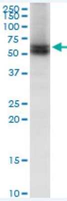 Western Blot: Lamin B Receptor Antibody [H00003930-B01P]