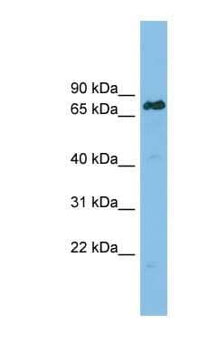 Western Blot: Lamin B Receptor Antibody [NBP1-59845]