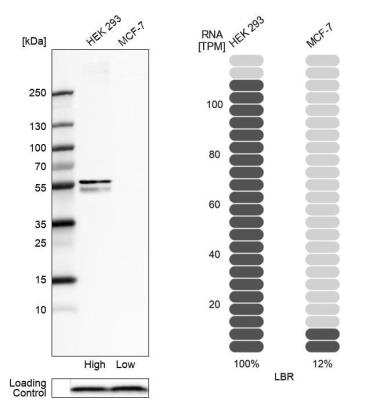 Western Blot: Lamin B Receptor Antibody [NBP2-56993]