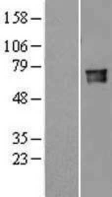 Western Blot: Lamin B Receptor Overexpression Lysate [NBL1-12453]