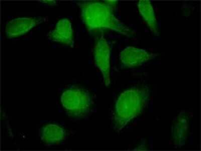 Immunocytochemistry/ Immunofluorescence: Lamin B1 Antibody (4B10) [H00004001-M01]